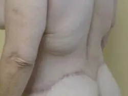 Pickart Plastic Surgery Before and After Pictures