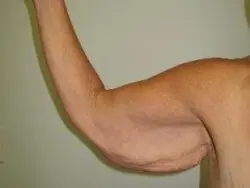 Pickart Plastic Surgery Before and After Pictures