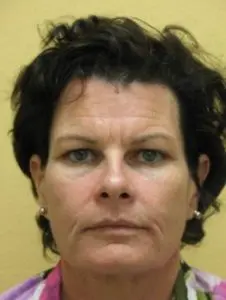 Pickart Plastic Surgery Before and After Pictures