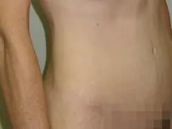 Pickart Plastic Surgery Before and After Pictures