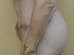 Pickart Plastic Surgery Before and After Pictures