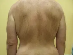 Pickart Plastic Surgery Before and After Pictures