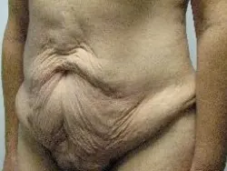 Pickart Plastic Surgery Before and After Pictures