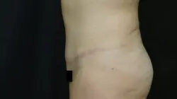 Pickart Plastic Surgery Before and After Pictures