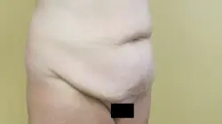 Pickart Plastic Surgery Before and After Pictures