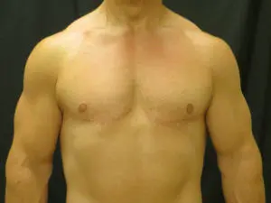 Pickart Plastic Surgery Before and After Pictures