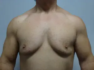 Pickart Plastic Surgery Before and After Pictures