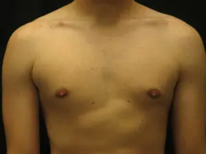 Pickart Plastic Surgery Before and After Pictures