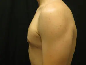 Pickart Plastic Surgery Before and After Pictures