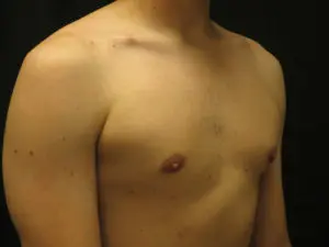 Pickart Plastic Surgery Before and After Pictures